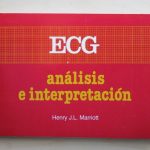ECG. Análisis e interpretación