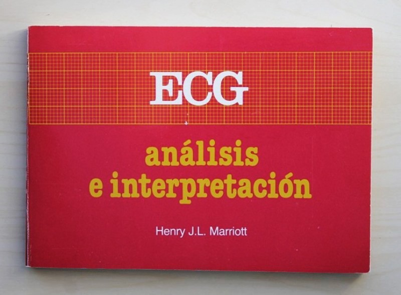 ECG. Análisis e interpretación