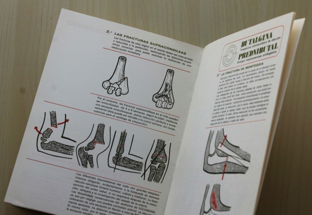 EL CODO DOLOROSO.  (Col. 8 casos prácticos de reumatología, nº 5) - Imagen 2